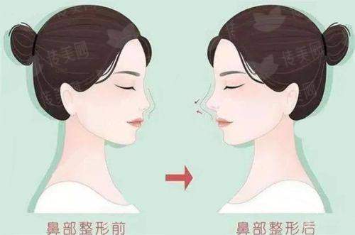 三、昭通昭美医疗美容门诊部的专精优势