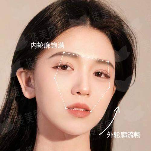 一、术前准备：为理想蜕变打好基础