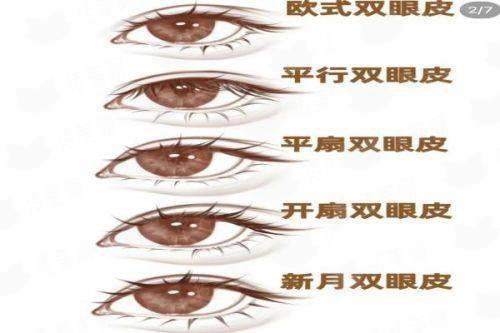 昆山玥美医疗美容双眼皮做得怎么样？预约方式与到院路线全解析