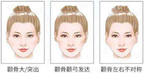 一、郑州芊美整形的隆鼻整形有哪些特色技术？
