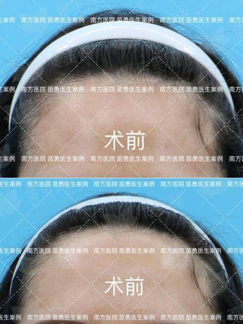 二、北京雍禾植发的发际线种植医生团队如何？