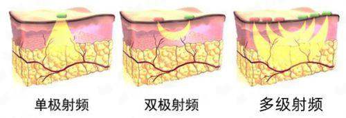 三、赣州俪人医疗美容真实实例对比