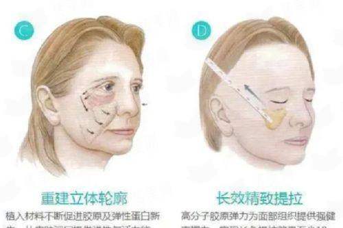 <strong>四、如何预约上海美莱整形口腔的关灿彬医生进行面诊？</strong>
