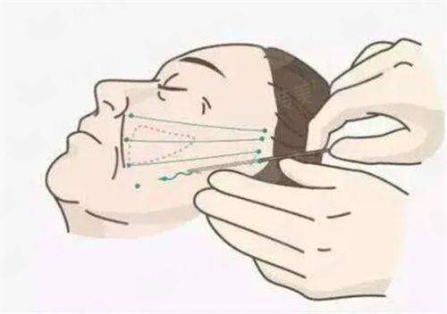 <strong>四、<strong>关于北京联合丽格第一整形医院何医生peek下巴整形的总结与贴心建议</strong></strong>