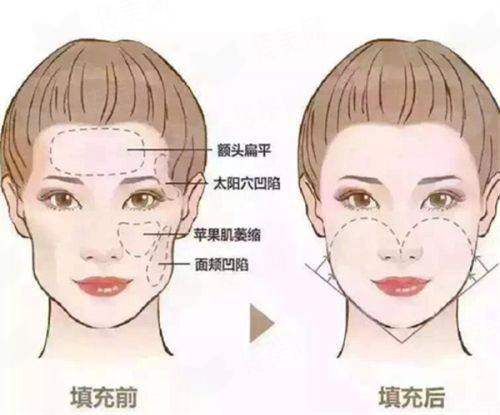 <strong>四、如何预约厦门福州泉州重森植发的党鹏院长面诊？</strong>