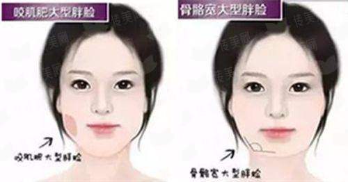 <strong>二、<strong>呼和浩特韩赋医疗美容的“其他针剂”技术有何特色？</strong></strong>