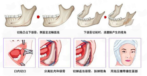 <strong>三、重庆军美医疗美容医院的兰宇肉毒素，价格贵不贵？成效能维持多久？</strong>