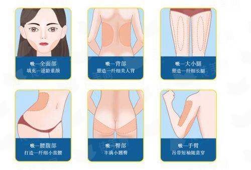 <strong>四、如何预约中信惠州医院整形中 心的玻尿酸面诊?</strong>
