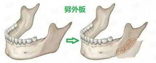 <strong>二、<strong>邯郸市华景医院医疗美容的眼眉整形有哪些特色项目？</strong></strong>
