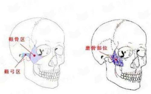 冯安民手术吸脂真实效果如何？成都华生铂悦医生信息与案例，新颜智尚小程序预约