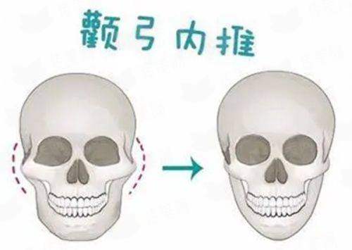 党鹏院长疤痕种植特色技术，重森植发医院介绍与案例推荐，新颜智尚小程序预约