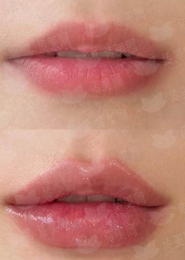 重庆军美兰宇医生：肉毒素精准除皱特色技术解析，新颜智尚小程序一键预约