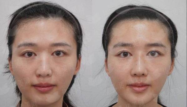 <strong>三、选择重庆华美整形口腔医院做面部轮廓，除了何才伟医生还有哪些优势？</strong>