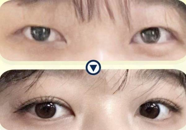 <strong>四、<strong>如何选择与预约郑州芳艺整形医院的关博瘦脸针？</strong></strong>