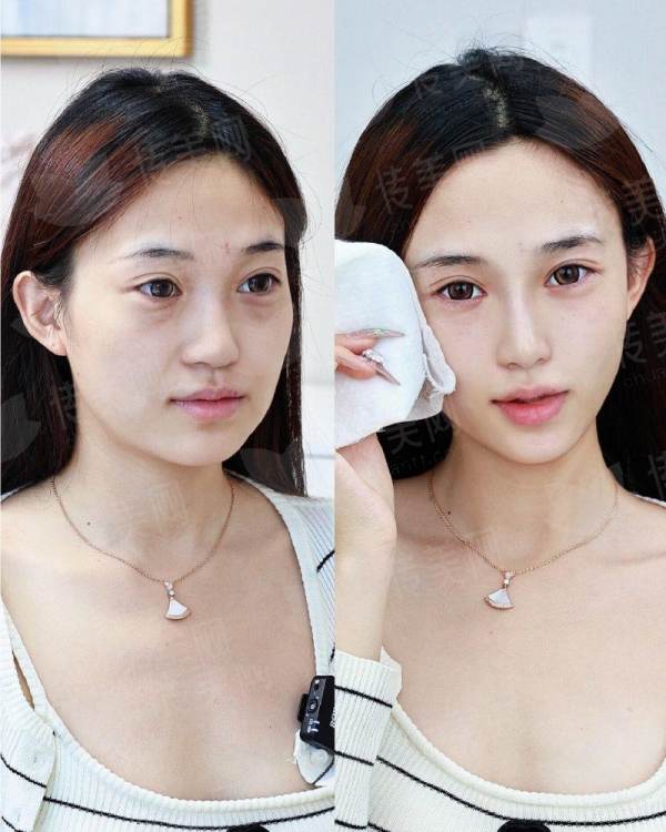 新颜智尚小程序一键预约北京禾美嘉，获取腰腹吸脂价格与医生信息