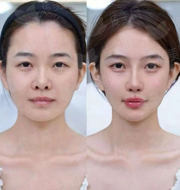 <strong>四、<strong>如何选择与预约邯郸市华景医院医疗美容的冬医生团队？</strong></strong>