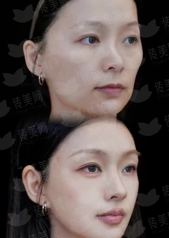 <strong>二、南京康美医疗美容医院的冀梅桂肉毒素技术好吗？</strong>