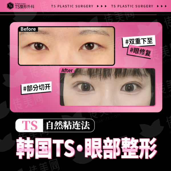 <strong>四、如何预约兰州韩美整形门诊部的双眼皮面诊？</strong>