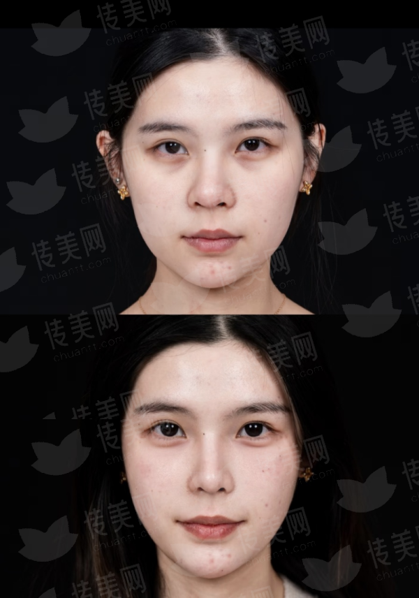 <strong>三、南京康美医疗美容医院的冀梅桂肉毒素有什么优势？</strong>