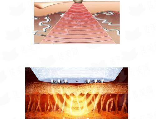 <strong>二、在武汉打童颜针，为什么推荐考虑武汉五洲整形外科医院？</strong>
