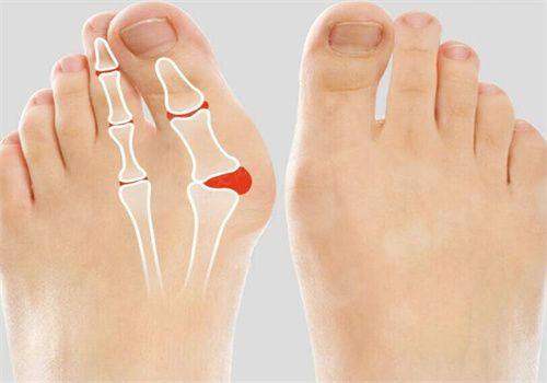 <strong>三、在株洲河东华美做脱毛，流程、价格与护理是怎样的？</strong>