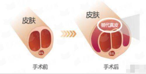 <strong>四、<strong>如何预约安徽芜湖名姝医疗美容医院的手臂吸脂面诊？</strong></strong>