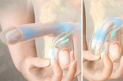 <strong>三、在成都做疤痕整形，大概要花多少钱？</strong>