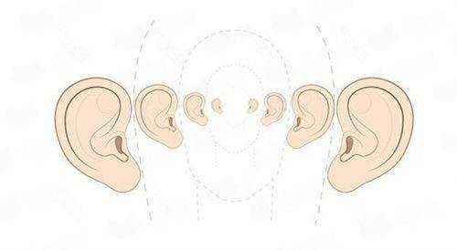 <strong>二、兰州华美（亚韩）的刘强硅胶假体隆鼻技术好吗？</strong>
