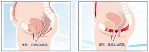 普宁安琪整形其他针剂项目，包含玻尿酸等，新颜智尚小程序预约享优惠