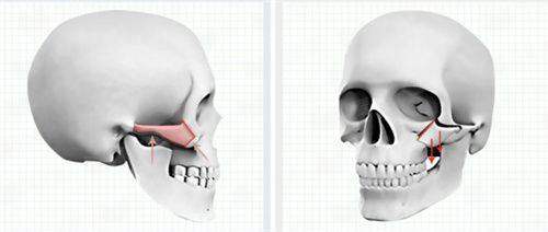 <strong>二、<strong>成都武侯区艾米丽医疗美容医院的双眼皮手术方式如何选择？</strong></strong>