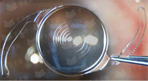 <strong>二、成都大麦植发医疗连锁的毛发种植医生团队实力如何？</strong>