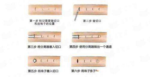 <strong>二、保定珍润医疗美容门诊部的刘宁除皱针技术安心可靠吗？</strong>