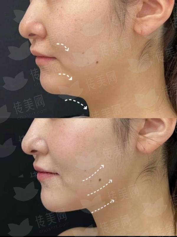 <strong>二、成都友谊医院疤痕科的医生团队与技术实力如何？</strong>