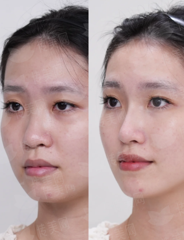 毛发种植选择成都大麦植发，新颜智尚小程序预约享优惠，附价格了解与到院路线