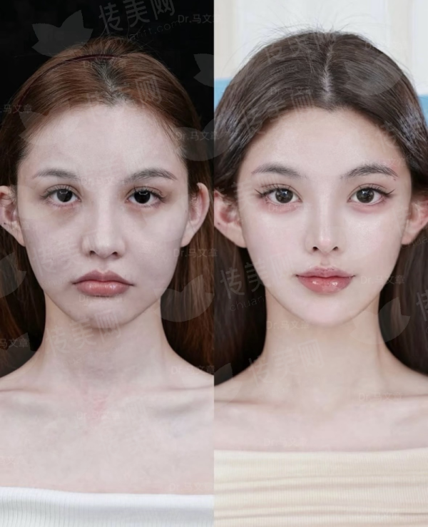 <strong>四、成都华美紫馨医美口腔医院如何选择与预约？</strong>