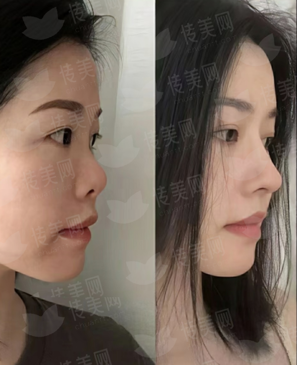 <strong>二、想找刘常菊医生做皮肤激光，在湖北武汉江城整形外科医院如何实现？</strong>