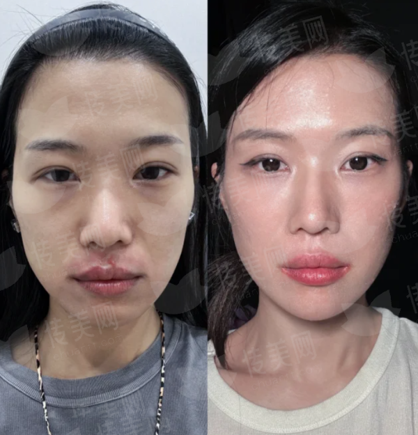 <strong>三、在沈阳做皮肤激光，还有其他靠谱选择吗？</strong>