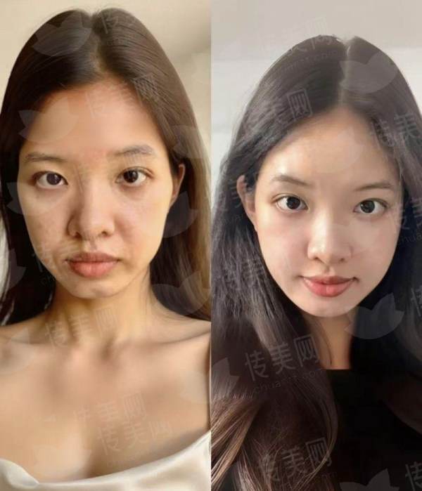 <strong>三、在湖北武汉江城整形外科医院做皮肤激光，价格和成效如何保护？</strong>