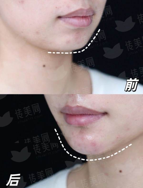 <strong>四、在武汉选择皮肤激光医院，湖北武汉江城整形外科医院有哪些优势？</strong>