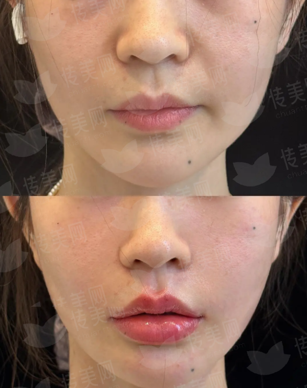 <strong>四、成都大麦植发医疗连锁如何选择与预约？</strong>