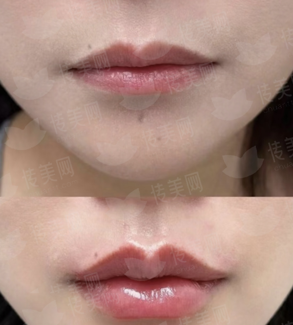 沈阳名流皮肤激光项目价格表来了，600 - 3000元/次，新颜智尚小程序可约