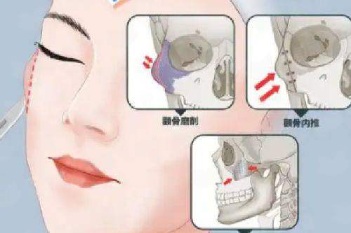 浙江杭州整形医院高难度鼻修复，医生信息、医院介绍及新颜智尚预约方式一览