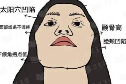 <strong>三、在抚州梦婷医疗美容做双眼皮有什么具体优势？</strong>