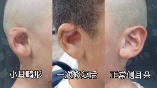 邵阳格莱美隆胸医生团队实力解析，预约方式：新颜智尚小程序一键预约