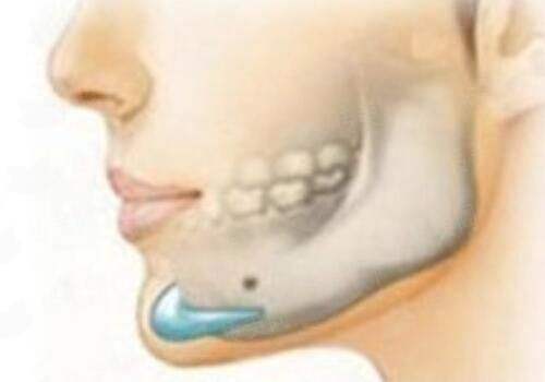 <strong>三、<strong>除了钟青杰医生，东莞还有其他祛眼袋选择吗？如何对比？</strong></strong>