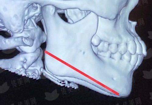 <strong>四、如何预约平顶山星美医疗美容的全切双眼皮面诊？</strong>