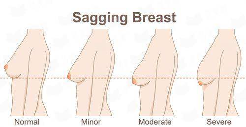 <strong>三、<strong>在徐州和平妇产医院做双眼皮，价格贵吗？</strong></strong>