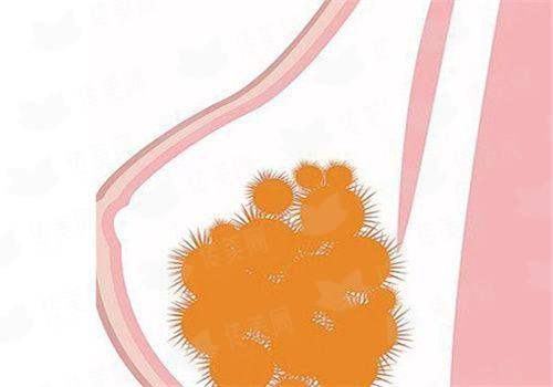 <strong>四、选择邯郸丽人整形做隆胸，如何保护安心与成效？</strong>