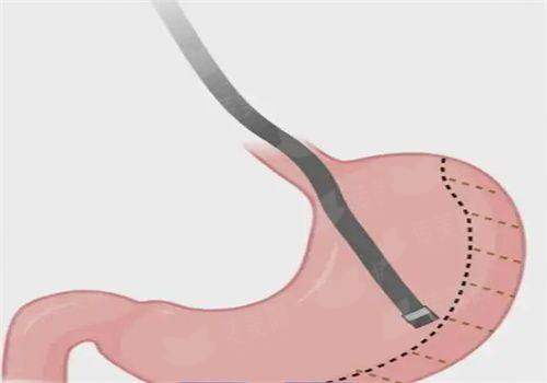 <strong>四、<strong>如何预约邯郸丽人整形的鼻修复骨干医生面诊？</strong></strong>