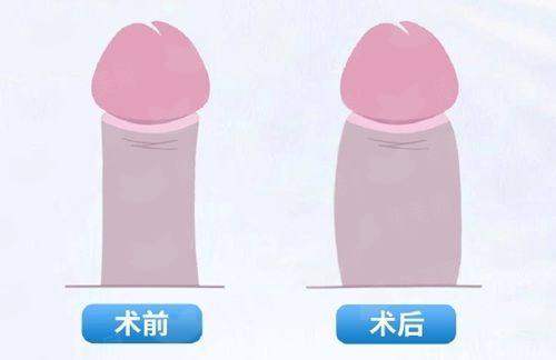 <strong>二、<strong>邯郸丽人整形如何解答“鼻修复几次是极限”？</strong></strong>